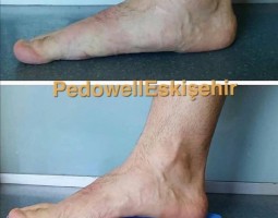 ortopedik-tabanlik_14.jpg